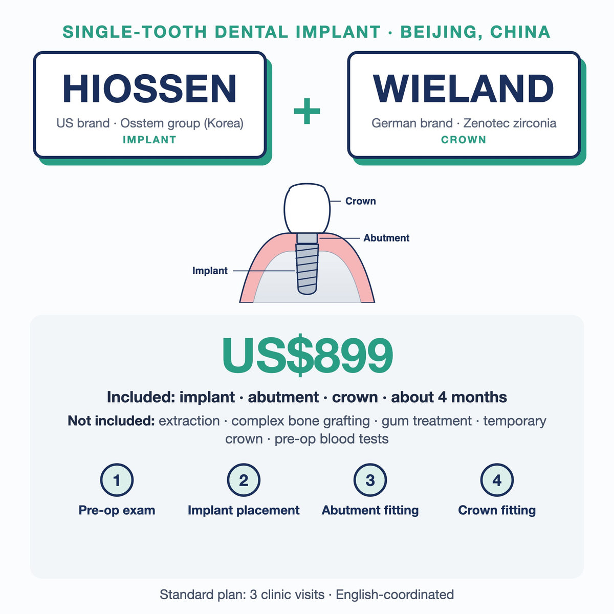 Single-tooth dental implant in Beijing, China: Hiossen implant (US brand, Osstem group, Korea) + Wieland Zenotec zirconia crown, US$899. Implant, abutment and crown, about 4 months; extras such as extraction or bone grafting not included.