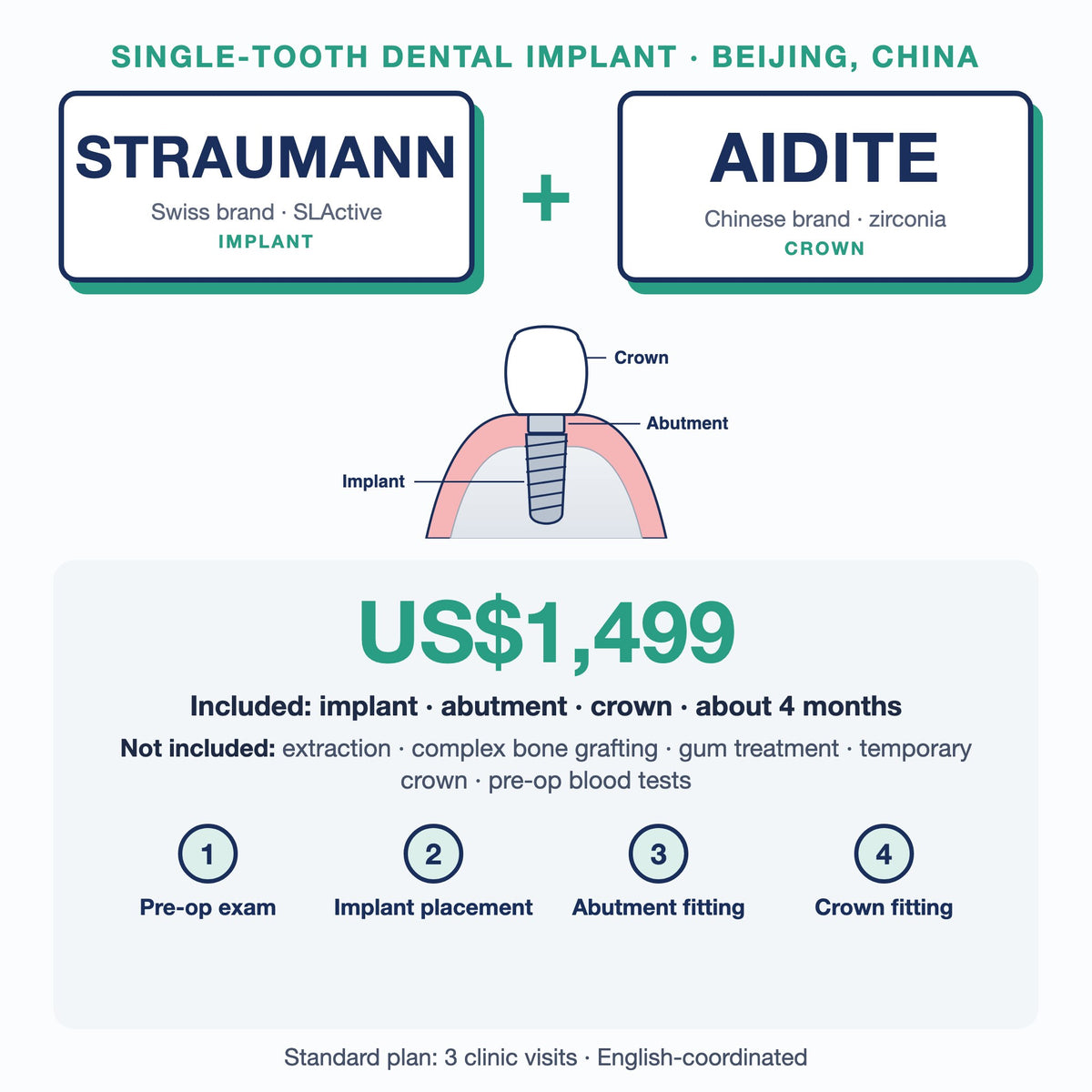 Single-tooth dental implant in Beijing, China: Straumann SLActive implant + Aidite zirconia crown, US$1,499. Implant, abutment and crown, about 4 months; extras such as extraction or bone grafting not included.
