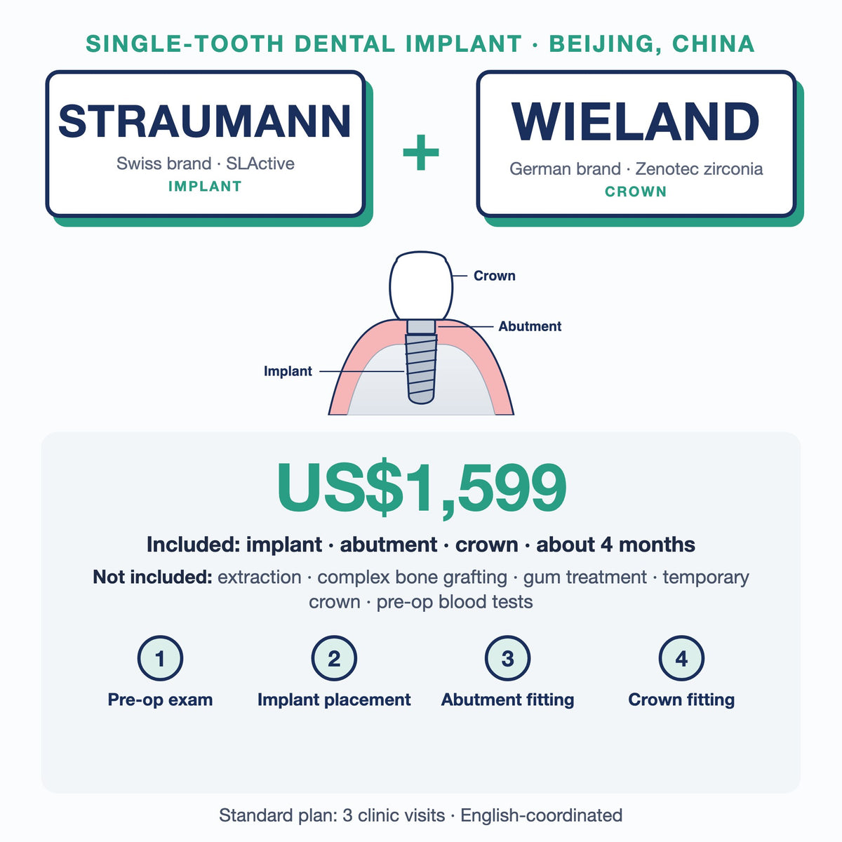 Single-tooth dental implant in Beijing, China: Straumann SLActive implant + Wieland Zenotec zirconia crown, US$1,599. Implant, abutment and crown, about 4 months; extras such as extraction or bone grafting not included.