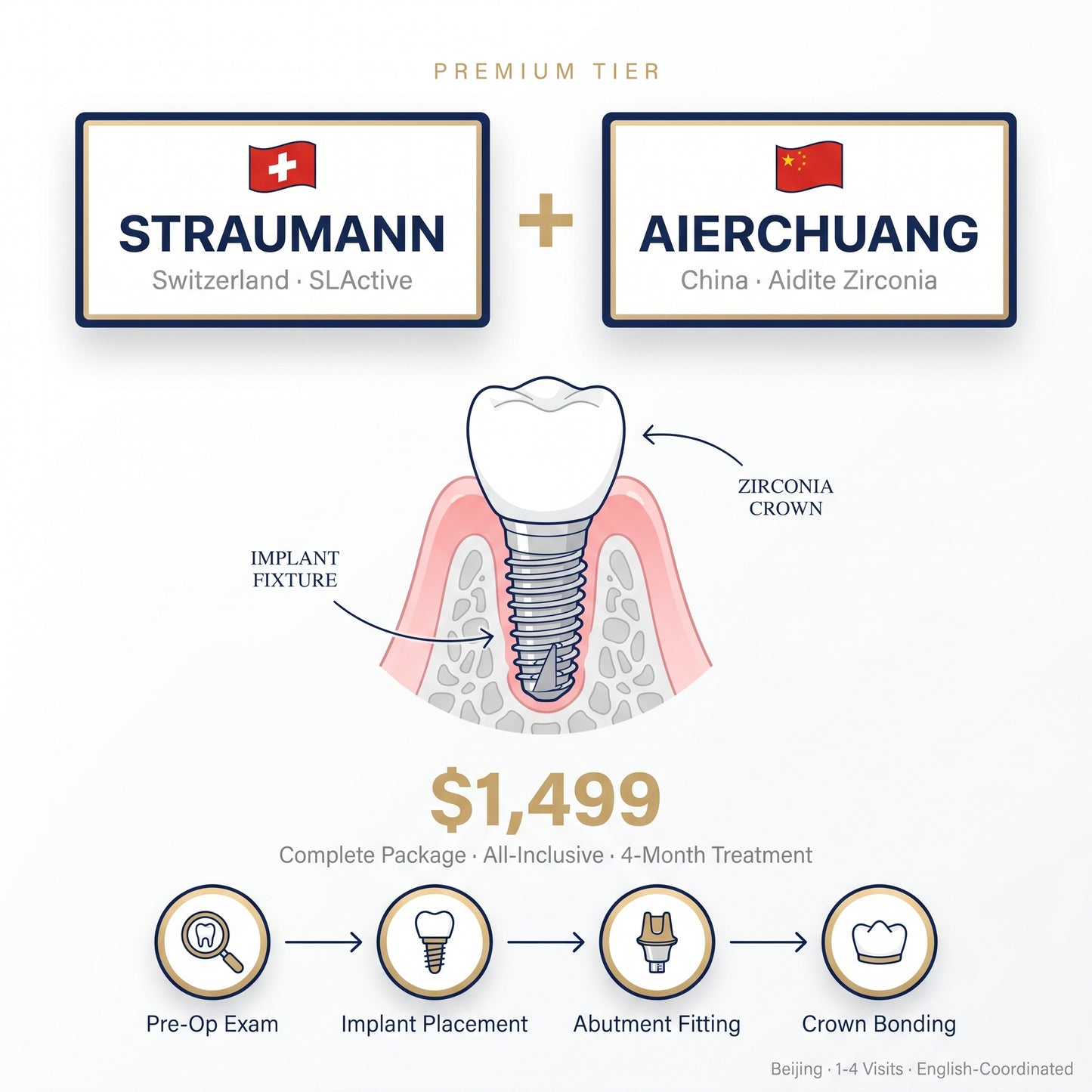 Dental implant package: Swiss Straumann + Aierchuang zirconia crown — $1,499 in Beijing