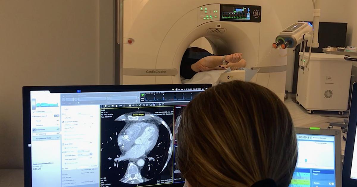 Coronary CT Angiography (CCTA) Add-On — China