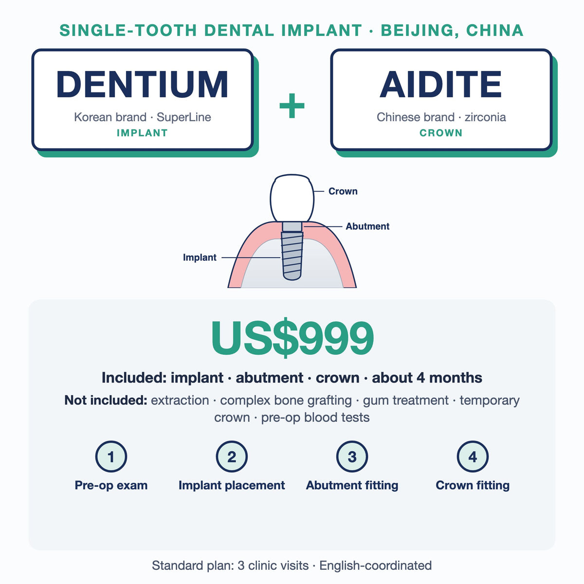 Single-tooth dental implant in Beijing, China: Dentium SuperLine implant + Aidite zirconia crown, US$999. Implant, abutment and crown, about 4 months; extras such as extraction or bone grafting not included.