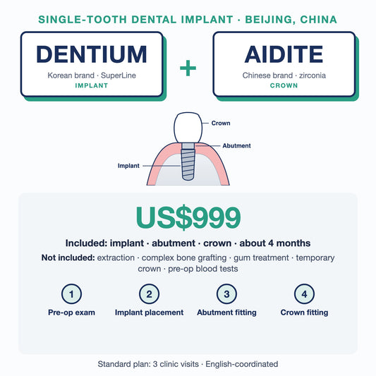Single-tooth dental implant in Beijing, China: Dentium SuperLine implant + Aidite zirconia crown, US$999. Implant, abutment and crown, about 4 months; extras such as extraction or bone grafting not included.