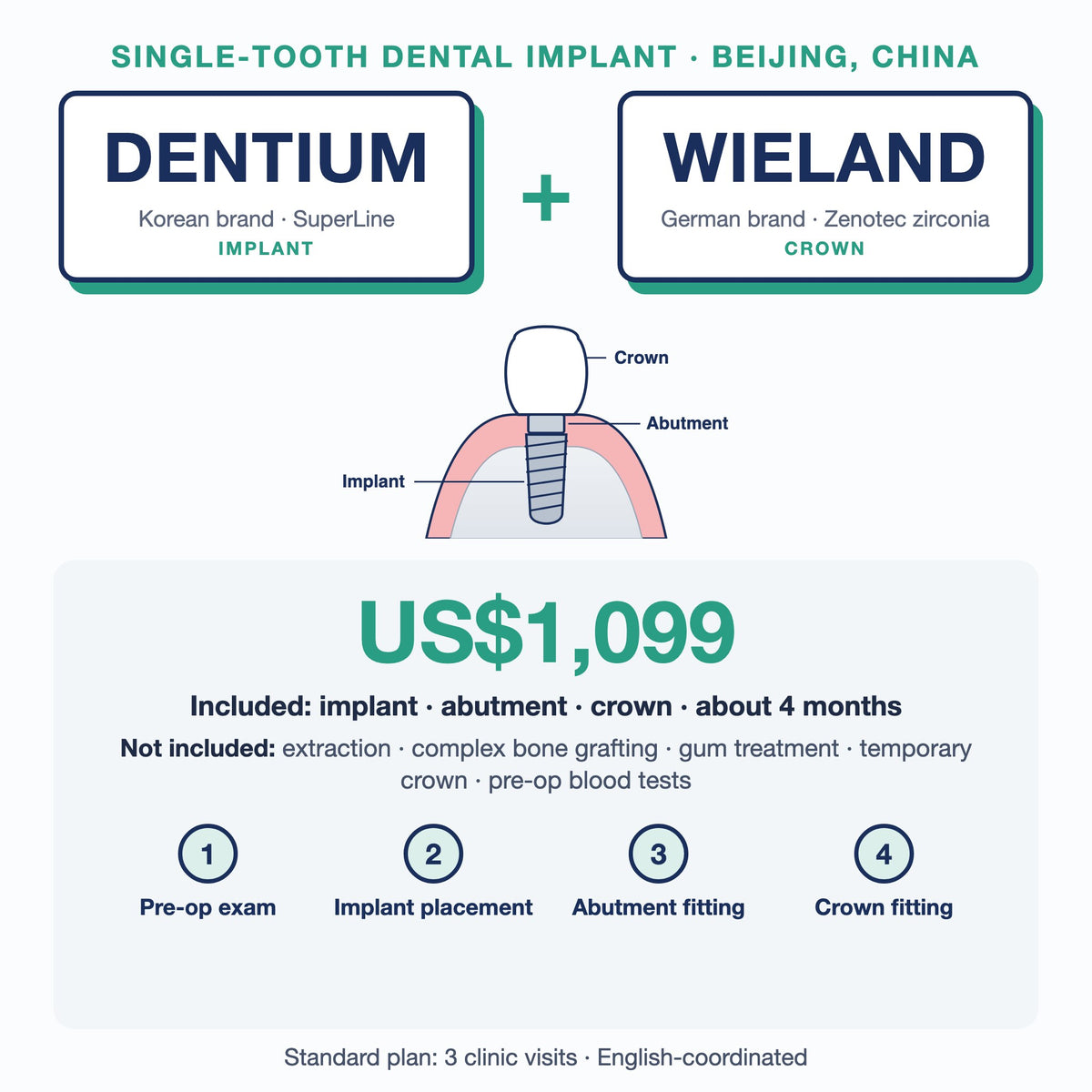 Single-tooth dental implant in Beijing, China: Dentium SuperLine implant + Wieland Zenotec zirconia crown, US$1,099. Implant, abutment and crown, about 4 months; extras such as extraction or bone grafting not included.
