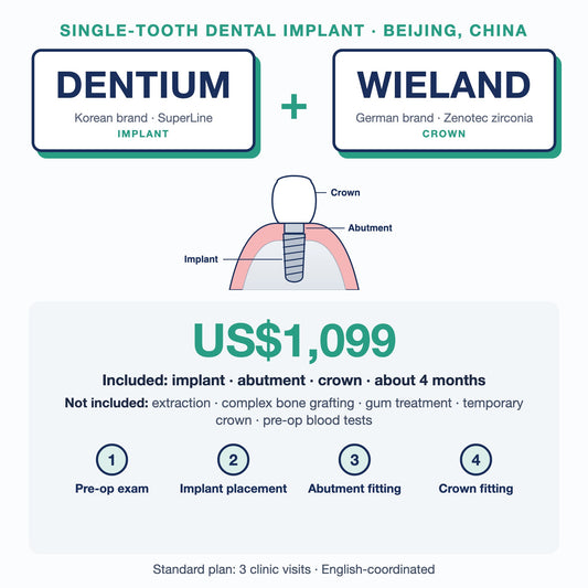 Single-tooth dental implant in Beijing, China: Dentium SuperLine implant + Wieland Zenotec zirconia crown, US$1,099. Implant, abutment and crown, about 4 months; extras such as extraction or bone grafting not included.