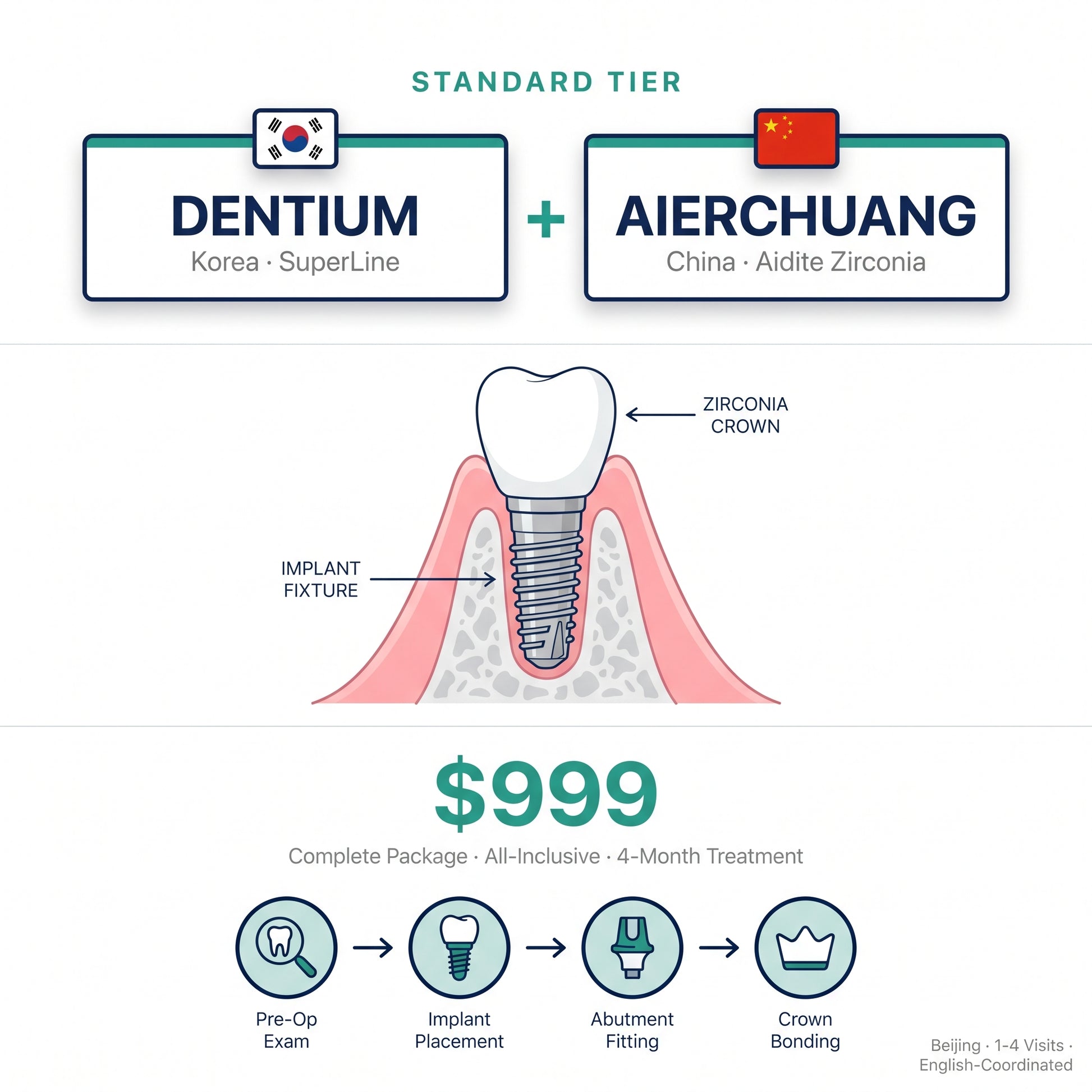 Dental implant package: Korean Dentium + Aierchuang zirconia crown — $999 in Beijing
