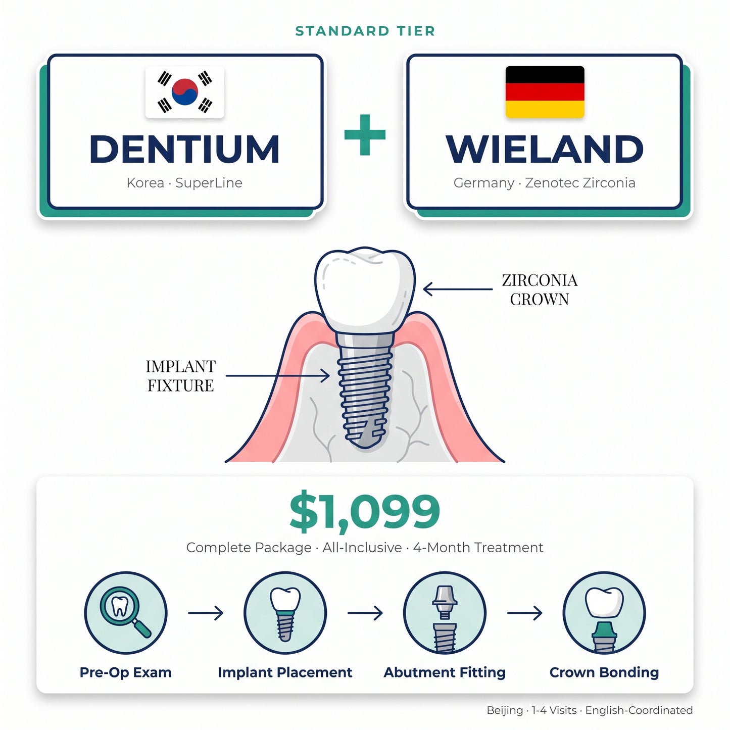 Dental implant package: Korean Dentium + German Wieland crown — $1,099 in Beijing