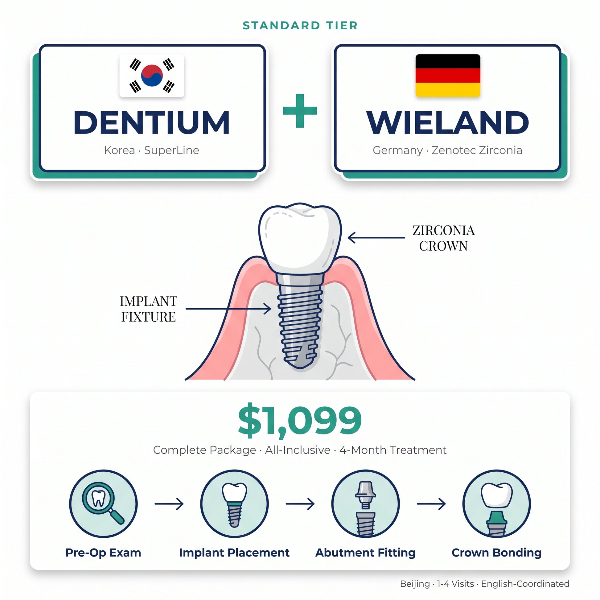 Dental implant package: Korean Dentium + German Wieland crown — $1,099 in Beijing