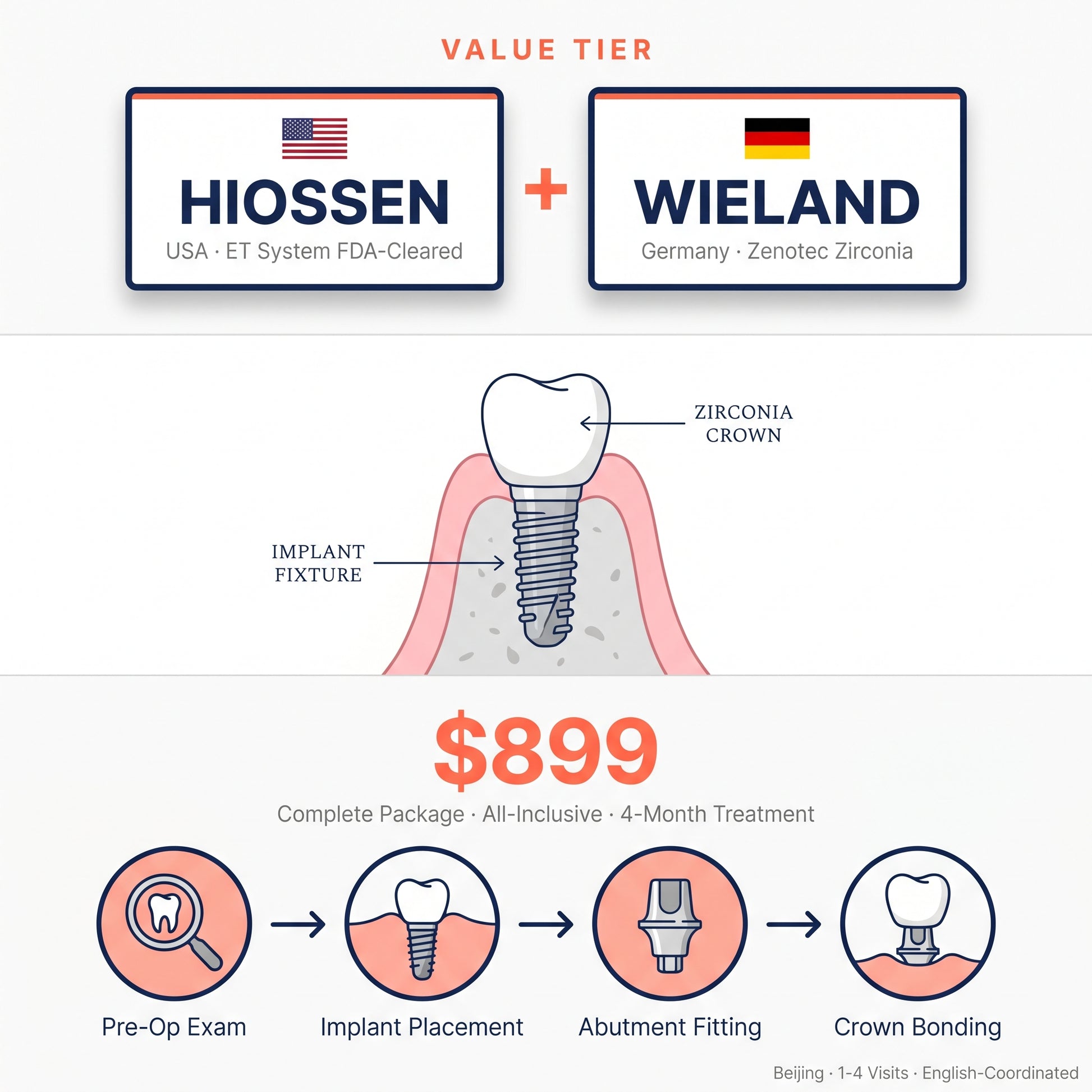 Dental implant package: Hiossen (USA/Korea) + German Wieland crown — $899 in Beijing