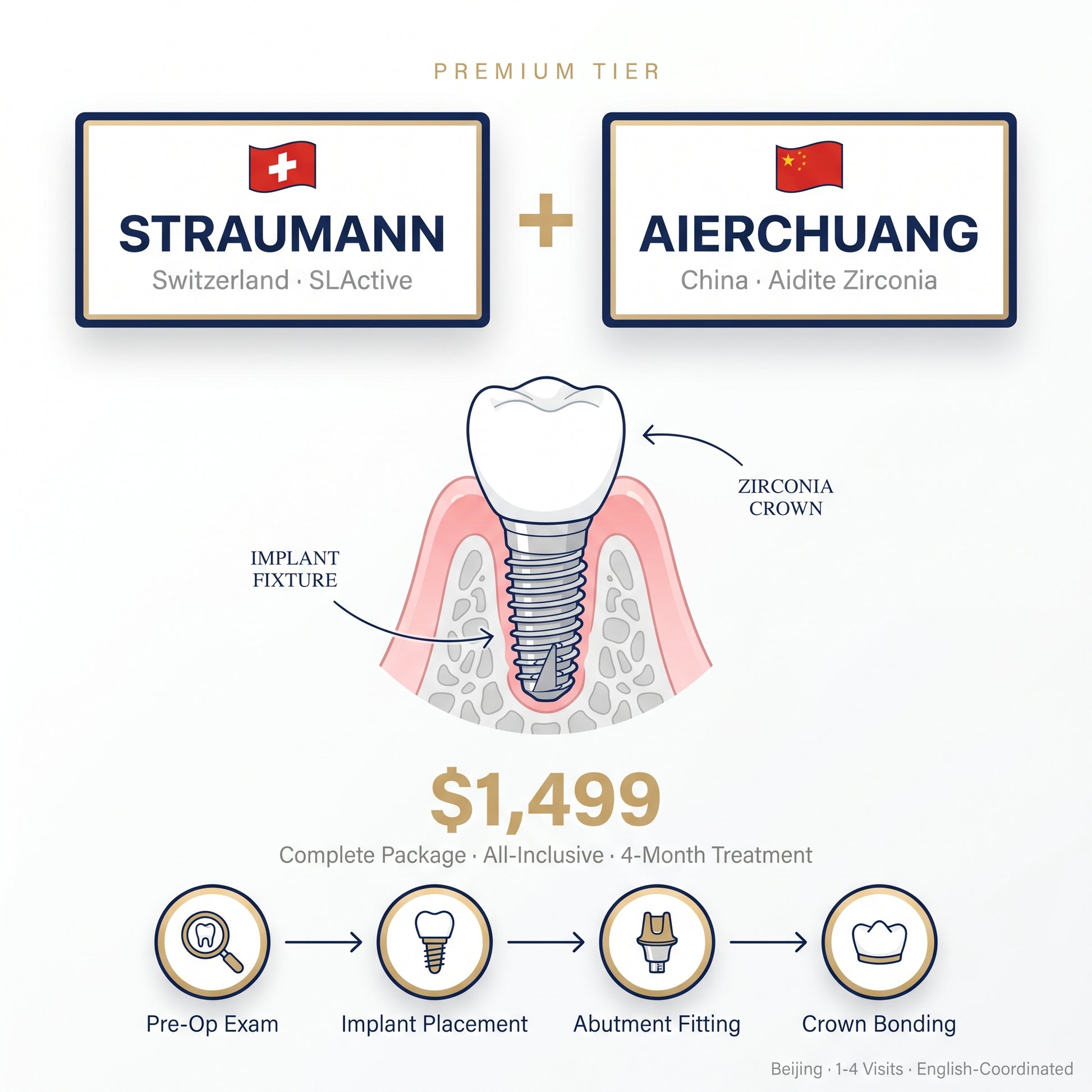 Dental implant package: Swiss Straumann + Aierchuang zirconia crown — $1,499 in Beijing